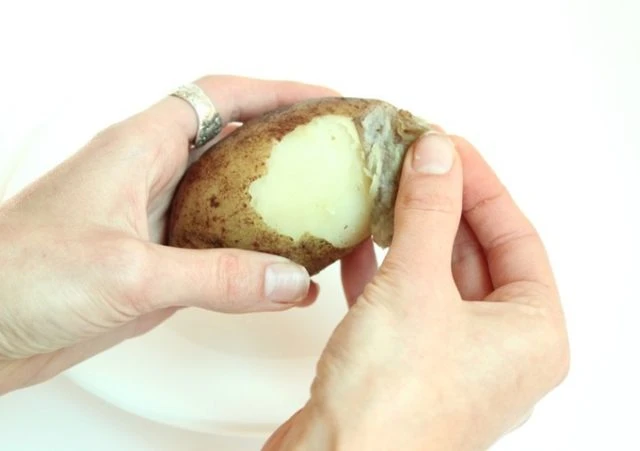 Güneş Yanığı Nasıl Geçer, Güneş Yanığına Ne İyi Gelir?